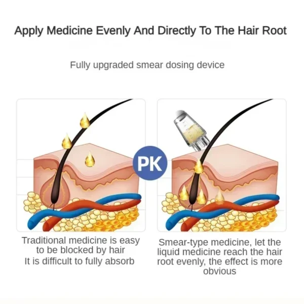 ScalpDrop™ – Peigne Applicateur de Soin Cuir Chevelu